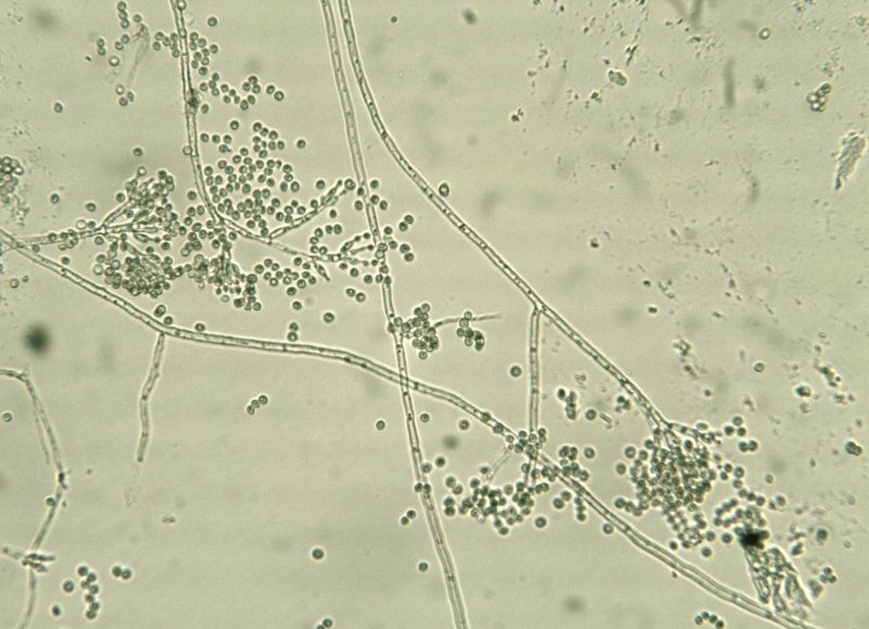 Penicillium 4.jpg